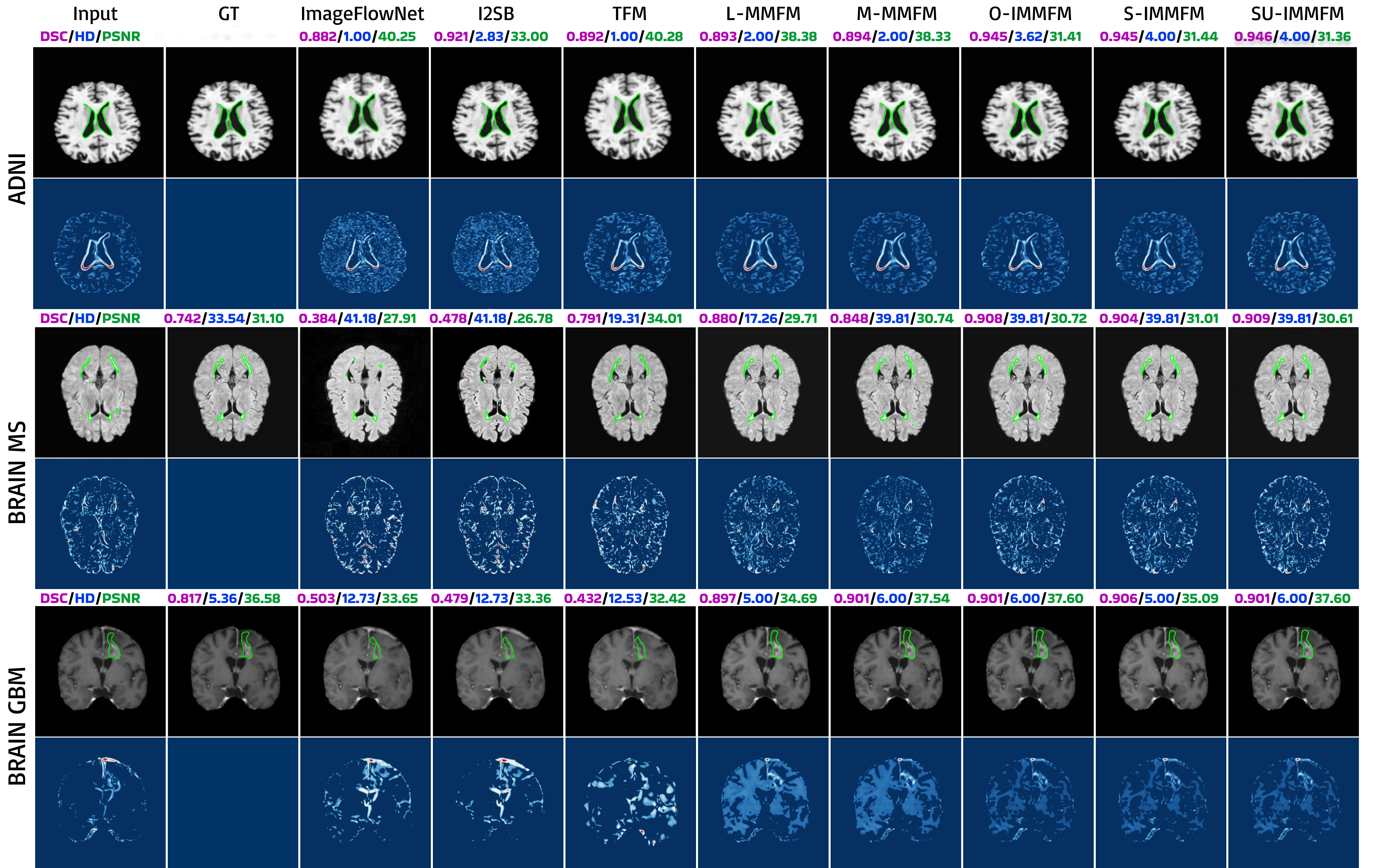 Figure 4: Real neuroimaging forecasts with error maps